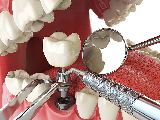 Best Emergency Orthodontic Repairs in Decatur, TN